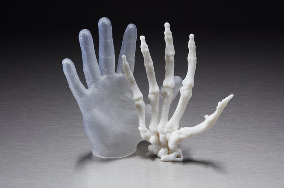 Exemple d'Impression 3D dans le secteurMédical : image montrant une main imprimée en 3D
