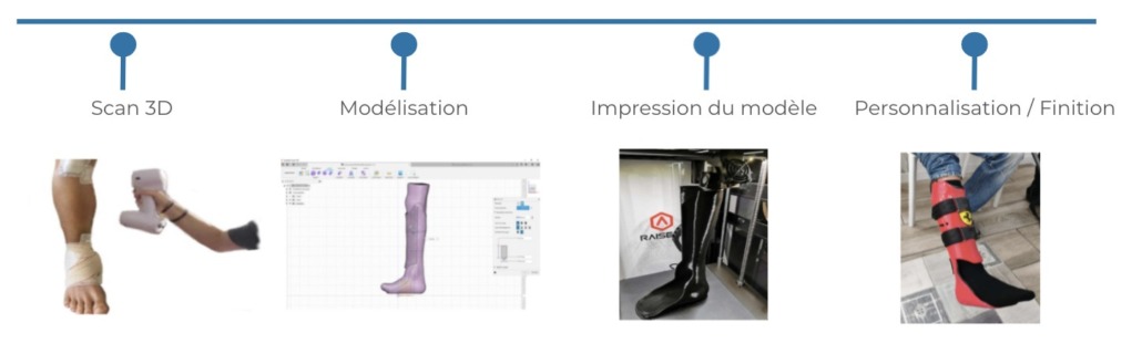 Etapes de la création d'orthèses en 3D