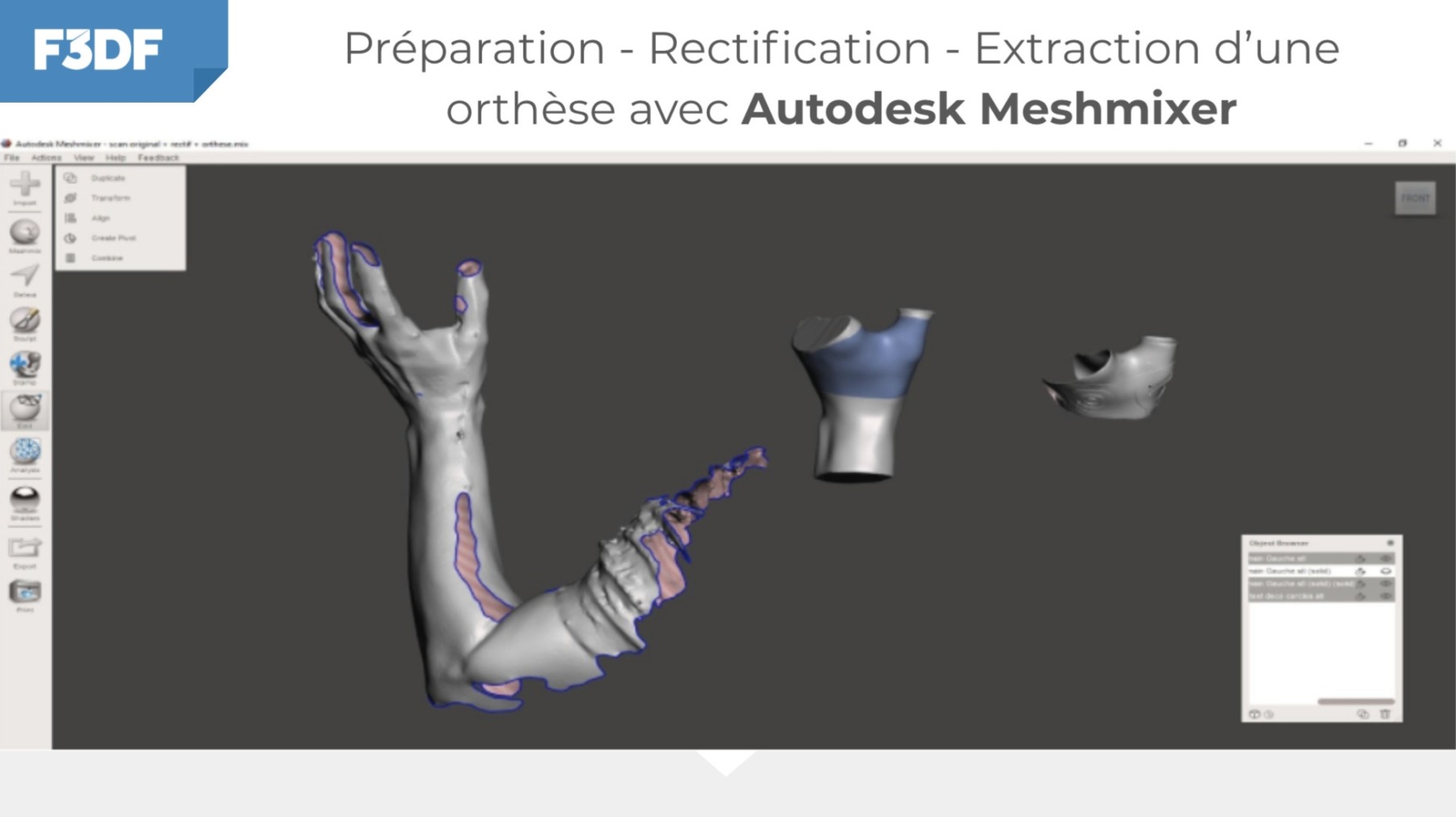 Utilisation du logiciel Meshmixer en orthopédie