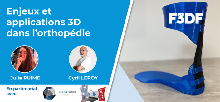 Live sur l'impression 3D en orthopédie
