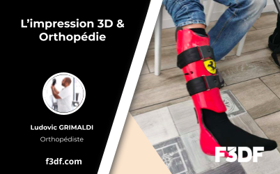 impression_3D_orthopedie